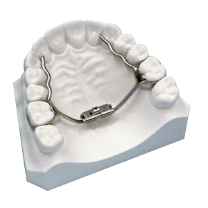 Rapid Palatal Expander - Align Orthodontics : Align Orthodontics